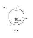 Fig. 10 - Systems and methods for weaponry with lower tip current electrode