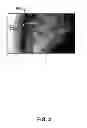 Fig. 03 - Method and system for obtaining a sequence of x-ray images using a reduced dose of ionizing radiation