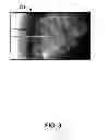 Fig. 04 - Method and system for obtaining a sequence of x-ray images using a reduced dose of ionizing radiation