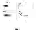 Fig. 09 - Method and system for obtaining a sequence of x-ray images using a reduced dose of ionizing radiation