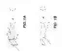 Fig. 02 - Computed radiography positioning method and system