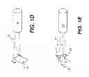 Fig. 04 - Computed radiography positioning method and system