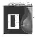 Fig. 01 - Breast tomosynthesis with display of highlighted suspected calcifications