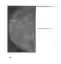Fig. 06 - Breast tomosynthesis with display of highlighted suspected calcifications