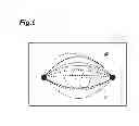 Fig. 07 - Eyelid detection device