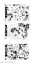 Fig. 16 - Method for production of zinc oxide particles