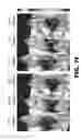 Fig. 30 - Nucleic acid probes and methods of using the same