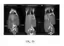 Fig. 12 - Melanocortin 1 receptor ligands and methods of use