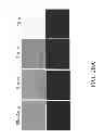 Fig. 28 - Melanocortin 1 receptor ligands and methods of use