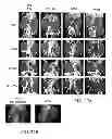 Fig. 44 - Melanocortin 1 receptor ligands and methods of use