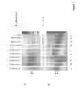 Fig. 02 - Method of treating lysosomal storage diseases