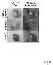 Fig. 15 - Methods for treatment of inflammatory and infectious viral diseases