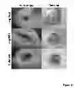Fig. 23 - Methods for treatment of inflammatory and infectious viral diseases