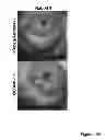 Fig. 31 - Methods for treatment of inflammatory and infectious viral diseases