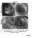 Fig. 33 - Methods for treatment of inflammatory and infectious viral diseases
