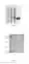 Fig. 03 - Multi-Target recombination gene and the application of its protein to prevent and cure 