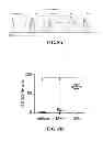 Fig. 11 - Allogeneic autophagosome-enriched composition for the treatment of disease