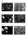Fig. 02 - Freeze-dried aripiprazole formulation