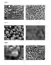 Fig. 04 - Freeze-dried aripiprazole formulation