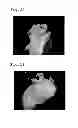 Fig. 07 - Freeze-dried aripiprazole formulation