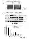 Fig. 23 - METHODS OF DETERMINING WHETHER THE WNT SIGNALING PATHWAY IS UPREGULATED IN A TUMOR