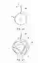 Fig. 05 - Maintaining a fixed distance by providing an air cushion during coating of a medical device