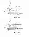 Fig. 06 - Maintaining a fixed distance by providing an air cushion during coating of a medical device