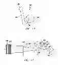 Fig. 08 - METHOD AND DEVICES FOR PLACING ROOT REPAIR MATERIALS FOR ROOT-END CAVITIES