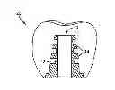Fig. 01 - FIXTURES FOR DENTAL IMPLANTS