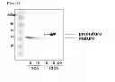 Fig. 04 - Method for converting and producing carbonate minerals from carbon dioxide using recombinant biocatalyst