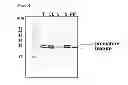 Fig. 06 - Method for converting and producing carbonate minerals from carbon dioxide using recombinant biocatalyst