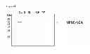 Fig. 07 - Method for converting and producing carbonate minerals from carbon dioxide using recombinant biocatalyst