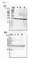Fig. 08 - Method for converting and producing carbonate minerals from carbon dioxide using recombinant biocatalyst