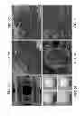 Fig. 06 - THREE DIMENSIONAL SOY PROTEIN-CONTAINING SCAFFOLDS AND METHODS FOR THEIR USE AND PRODUCTION