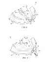 Fig. 04 - Golf club having removable weight