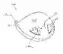 Fig. 01 - Golf club head