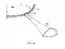 Fig. 17 - WEIGHTED ARTICLE WITH FILL SPOUT