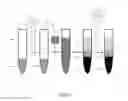 Fig. 02 - Sterilizable photopolymer serum separator