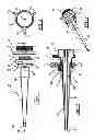 Fig. 02 - Tissue Retractor