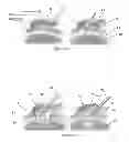 Fig. 02 - Materials and methods for repair of cartilage defects