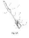 Fig. 02 - X-shaped device and method for deployment and placement of a patch