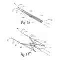 Fig. 07 - X-shaped device and method for deployment and placement of a patch
