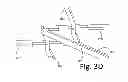 Fig. 09 - X-shaped device and method for deployment and placement of a patch
