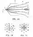 Fig. 02 - Non-entangling vena cava filter