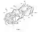 Fig. 02 - Implantation tools for interspinous process spacing device