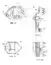 Fig. 05 - Implantation tools for interspinous process spacing device