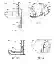 Fig. 06 - Implantation tools for interspinous process spacing device