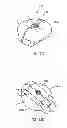 Fig. 22 - Implantation tools for interspinous process spacing device