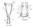Fig. 28 - Implantation tools for interspinous process spacing device