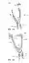 Fig. 32 - Implantation tools for interspinous process spacing device